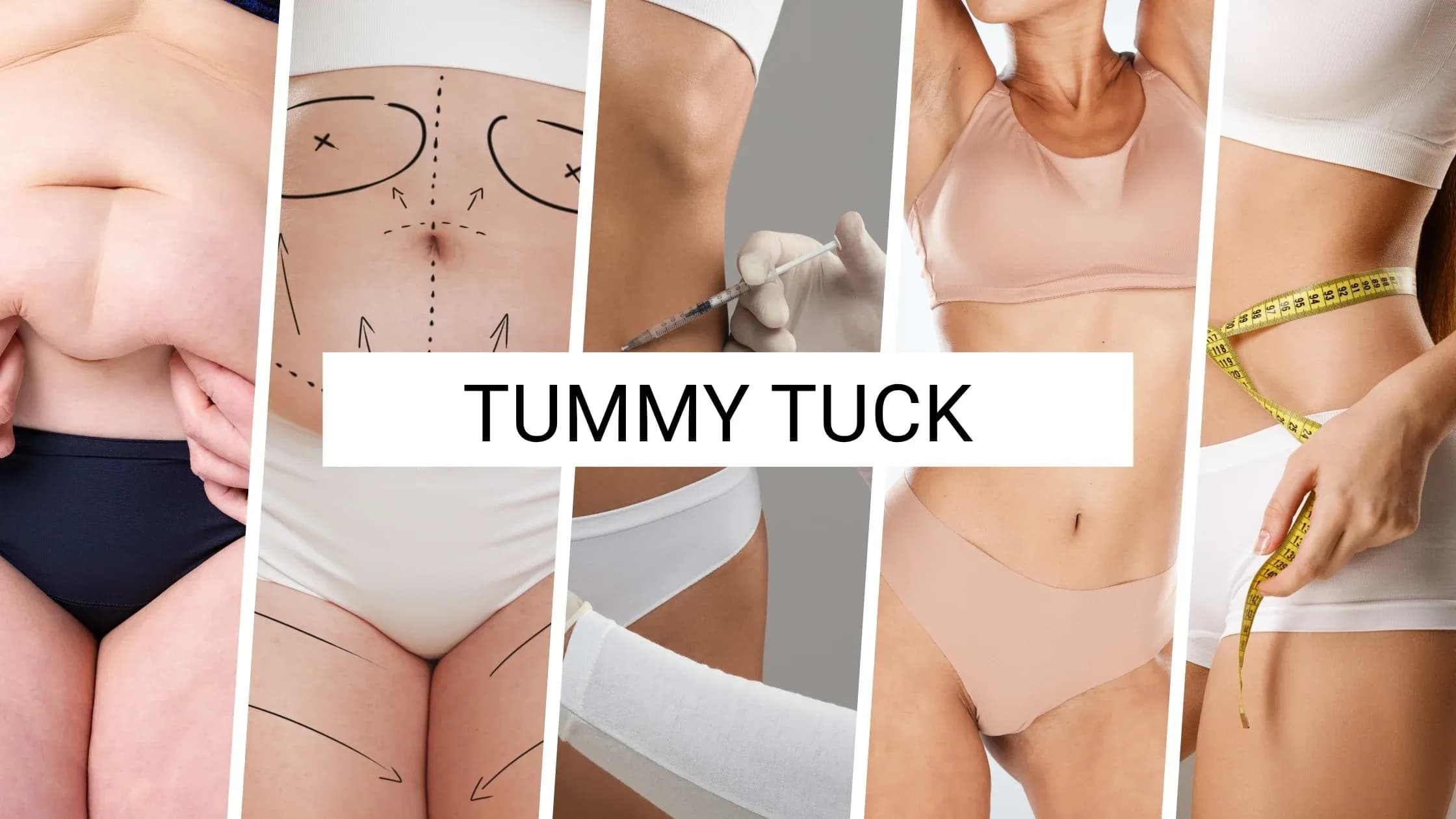 Tummy Tuck Recovery: What Really Happens After Surgery