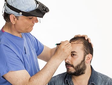 Hair Transplantation